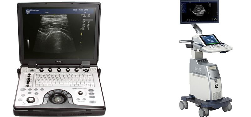 Buying an Ultrasound Scanner for MSK/Sports Medicine - Considerations