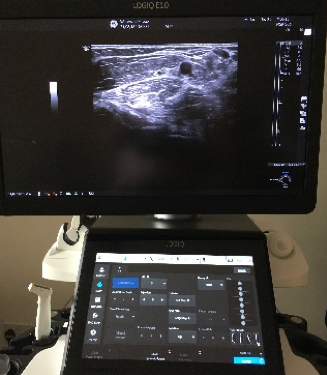 The GE E10 - Reviewed - A new standard in MSK Ultrasound imaging
