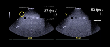 SMUG-leading the way into ultrasound imaging